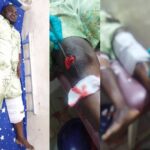 NASRE Director In Critical Condition After Crash, Group Mobilizes Support